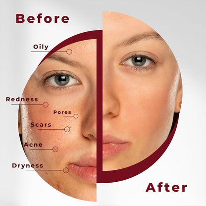 Turmeric Kojic Acid Cleansing Pads (60 Pads)