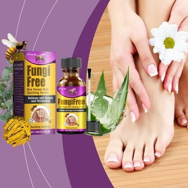 Fungi Free Nails – Natural Anti-Fungal Nail Serum (BUY 1 GET 1 FREE)