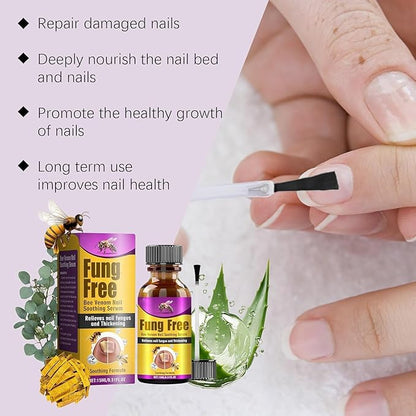 Fungi Free Nails – Natural Anti-Fungal Nail Serum (BUY 1 GET 1 FREE)